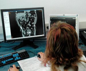 La Red de Imagen Digital del Sescam se refuerza con IA con una inversión de 14,2 millones para los próximos cuatro años
